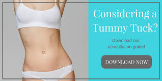 Tummy Tuck Consultation Guide DFW | Dallas Body Contouring Surgeon