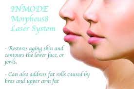 The Morpheus8 laser system by INMODE can contour small areas of fat. 