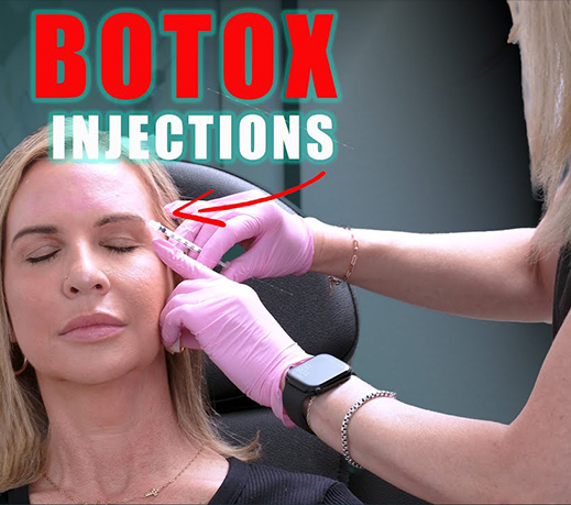 Botox Glow UP! Injections Live with Before and After
