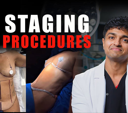Are Multiple SURGERIES at Once Putting You at RISK?