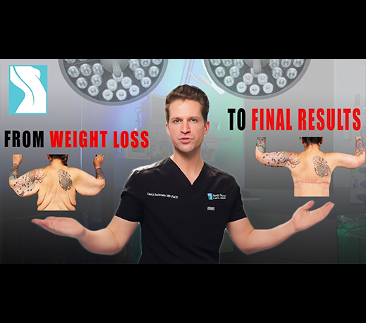 Designing a Surgical Plan After Weight Loss | Dr Anderson Before & After