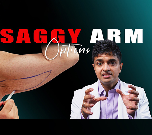 How to Get Rid of Loose Arm Skin | Arm Lift & Brachioplasty