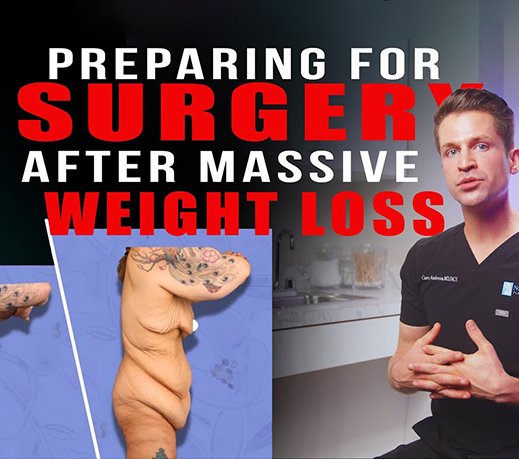 How to Prepare for Surgery After Massive Weight loss