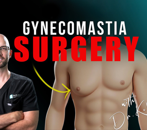 What is Gynecomastia and What Can Be Done About it?